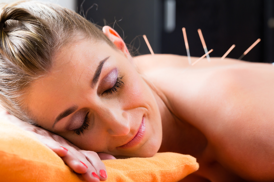 acupuncture TCM