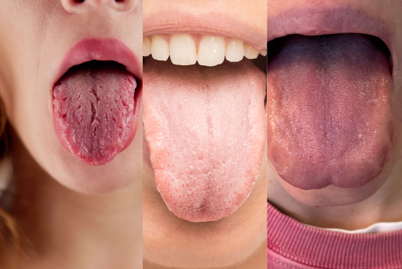 reading the tongue